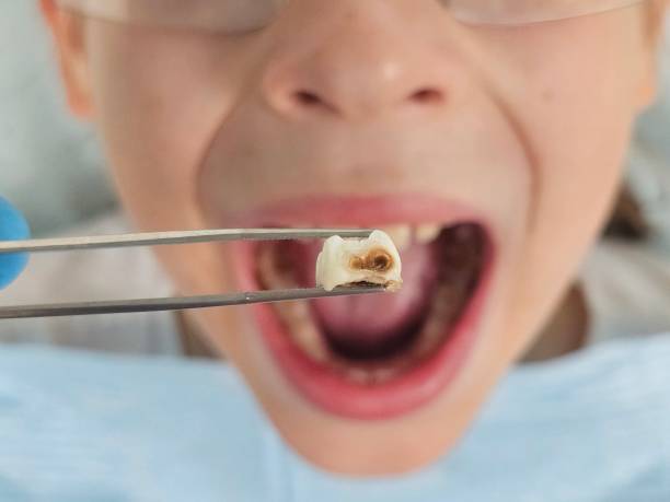 Best Emergency Dental Care for Sports Injuries in Brandywine, MD